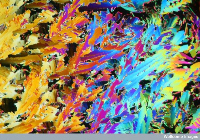 B0006208 Urea crystals